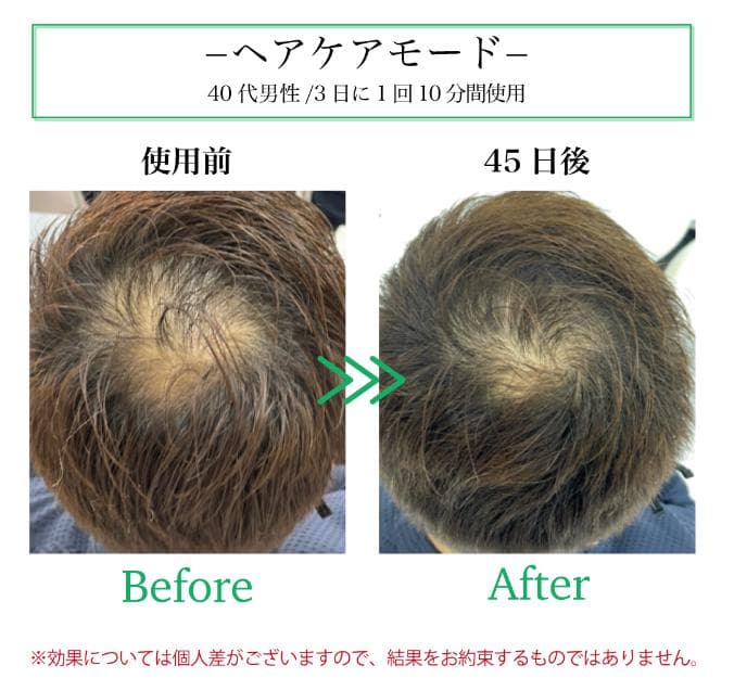 【未使用】 クールプロジェクト レディッチトリプロ 家庭用LED美容器