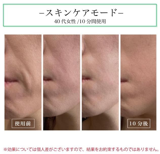 【未使用】 クールプロジェクト レディッチトリプロ 家庭用LED美容器