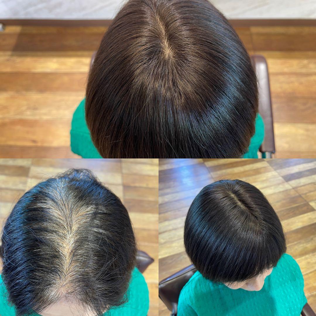 ナチュラルブラック100%レミー毛バランス調整済み部分ウィッグ(予約商品)