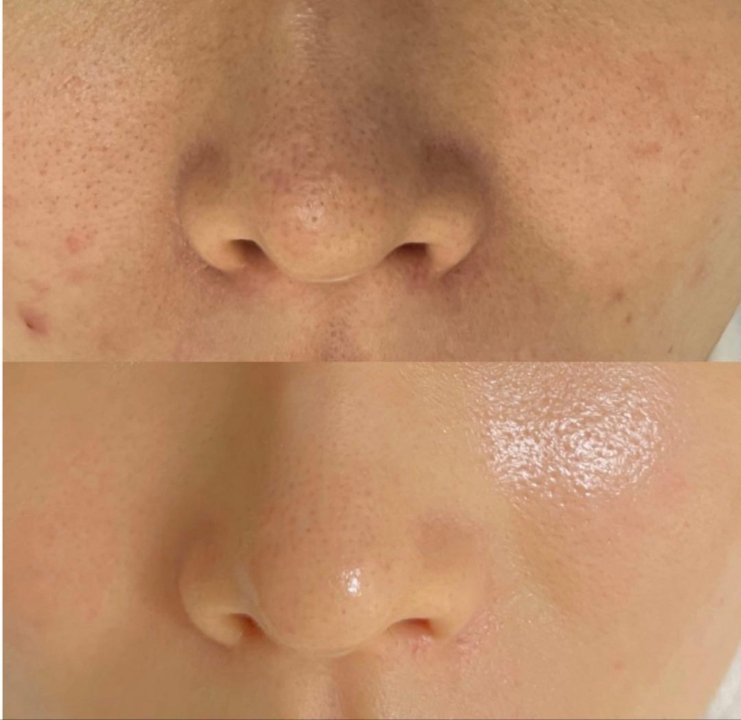 【即発送】セラピール2回分+ブラシ1セット+マスク2枚