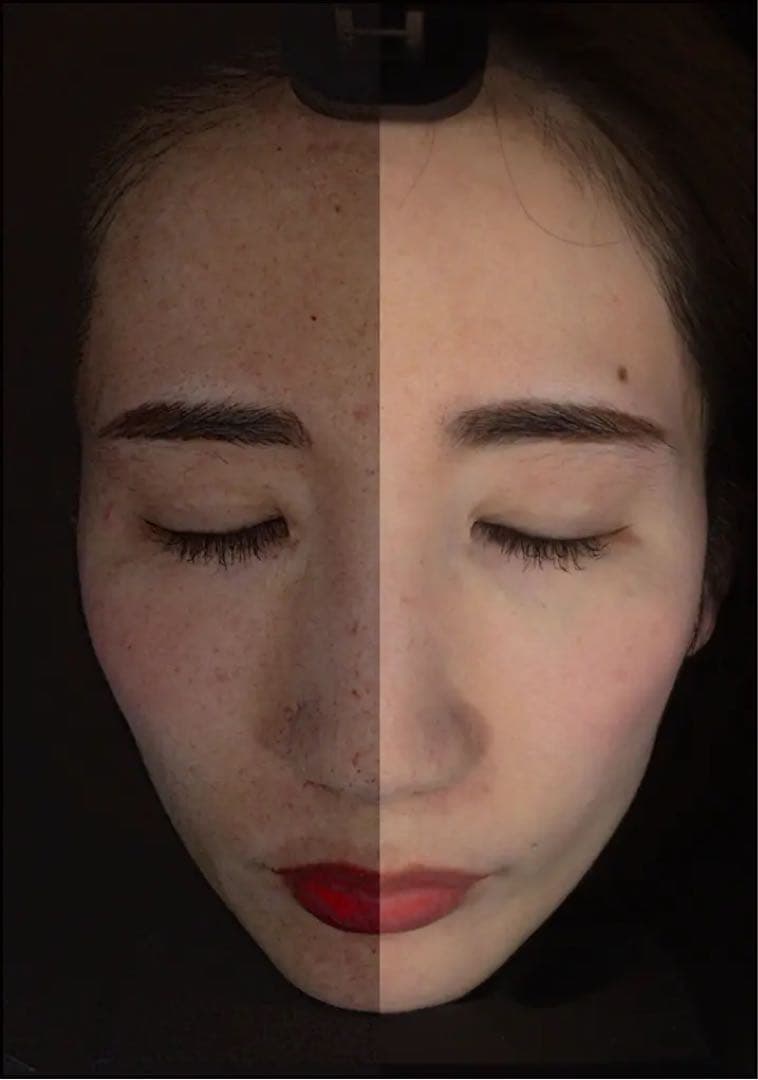 new〜　AX Face アクサフェイス　業務用サロン用