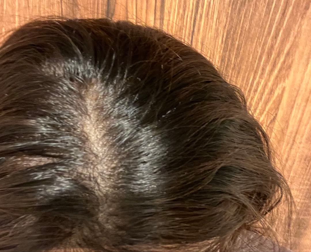 値下げOK!百合子ウィッグ☆FTレースタイプ45cm ナチュラルブラウン 医療用