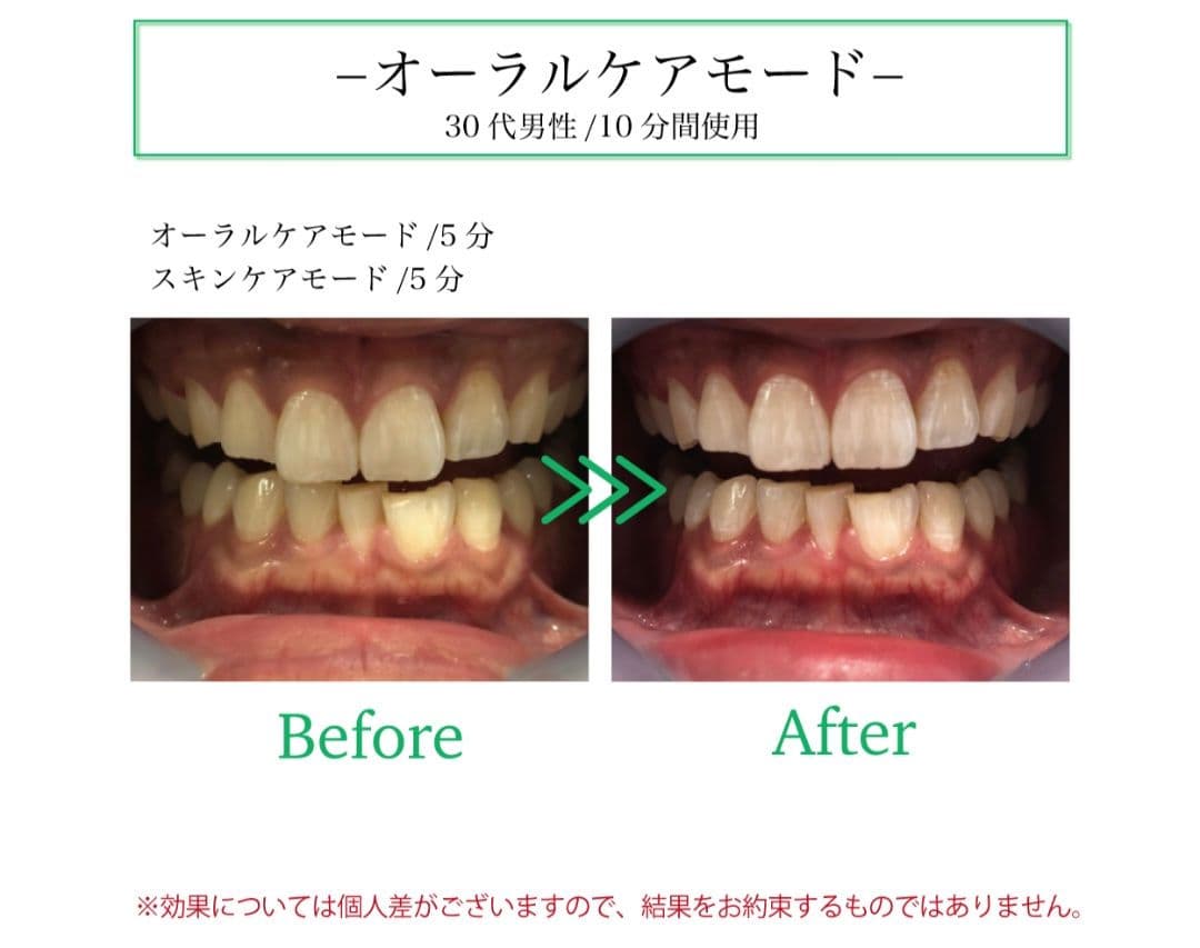 レディッチトリプロ【美品】♡美肌＊美髪＊オーラルケア