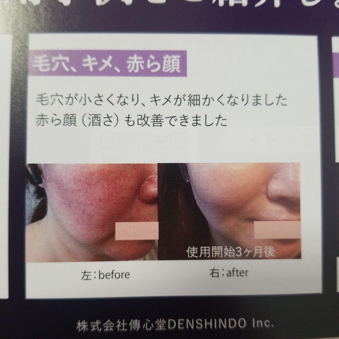 DENSHINDO プラズマエアシャワー美顔器 UN1-W ホワイト