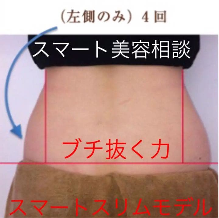 最新のポータブルRF顔マシン・肌のリフトアップ キャビテーション 業務用