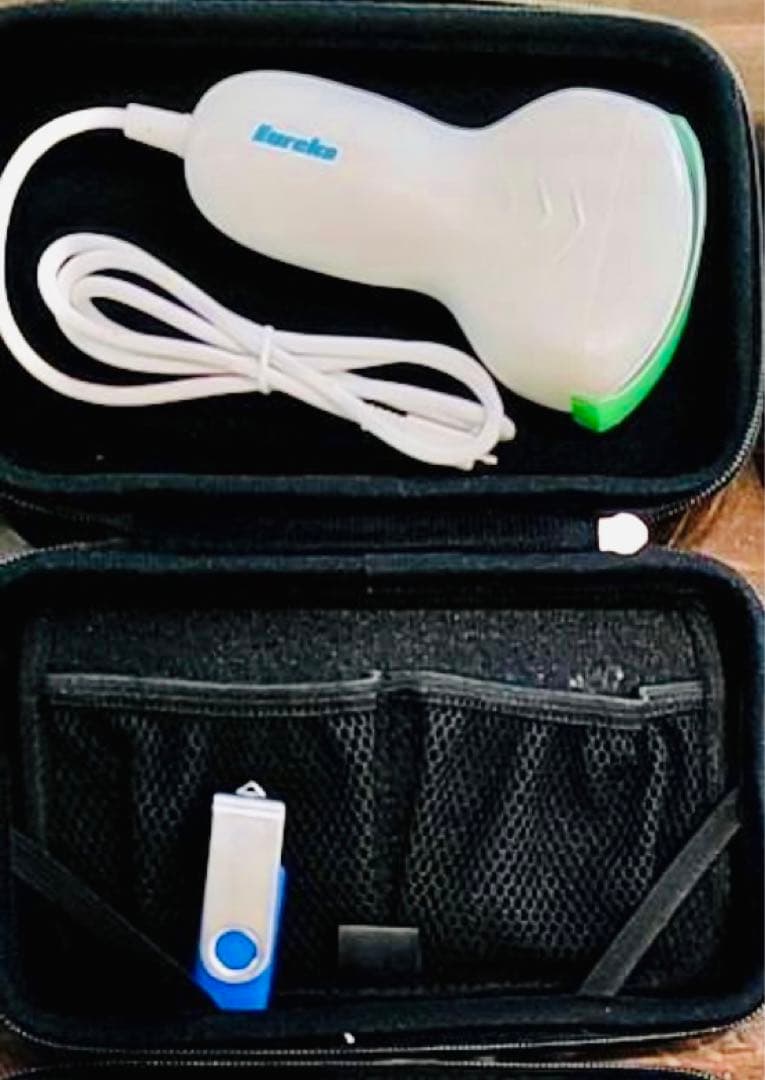 超音波検査装置（エコー）