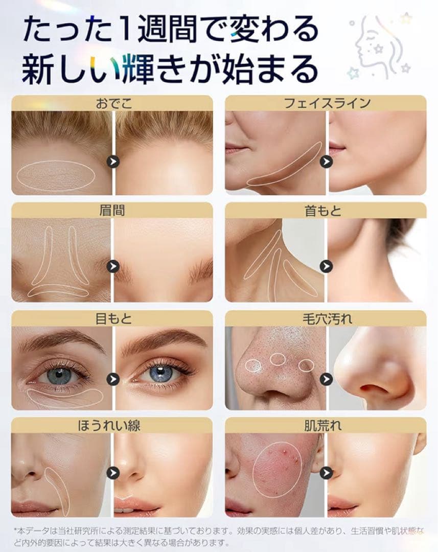 【新品・未使用】美顔器 高周波 EMS 1台18役 光エステ リフトケア