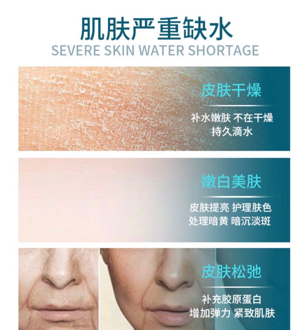 超音波導入 DEP ES（ダーモエレクトロポレーション）